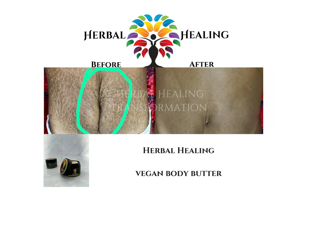 Herbal Healing Vegan Body Butter