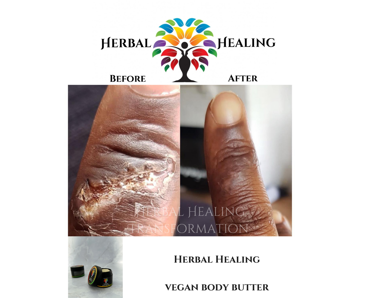 Herbalicious Skin Care Package