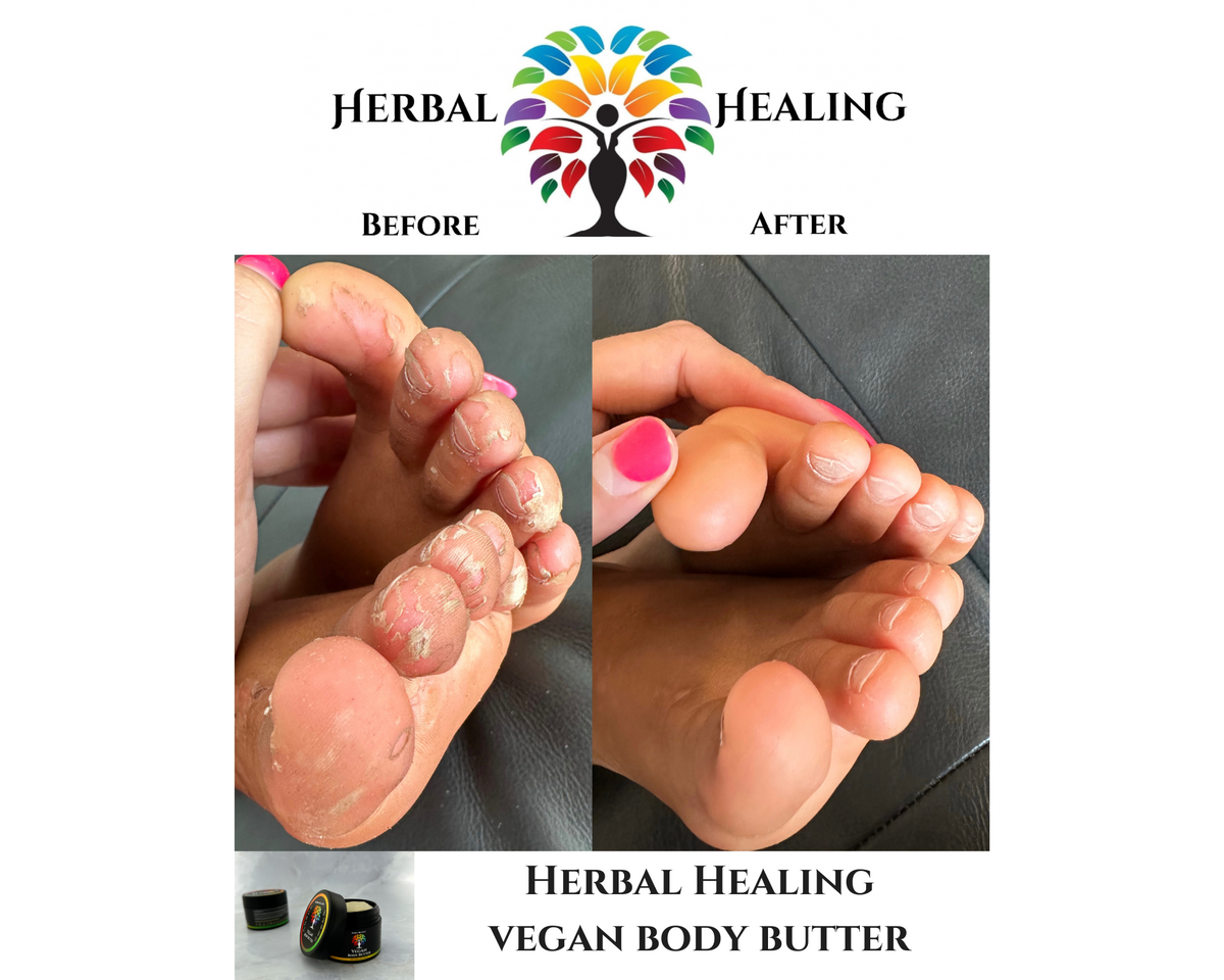 Herbal Healing Vegan Body Butter